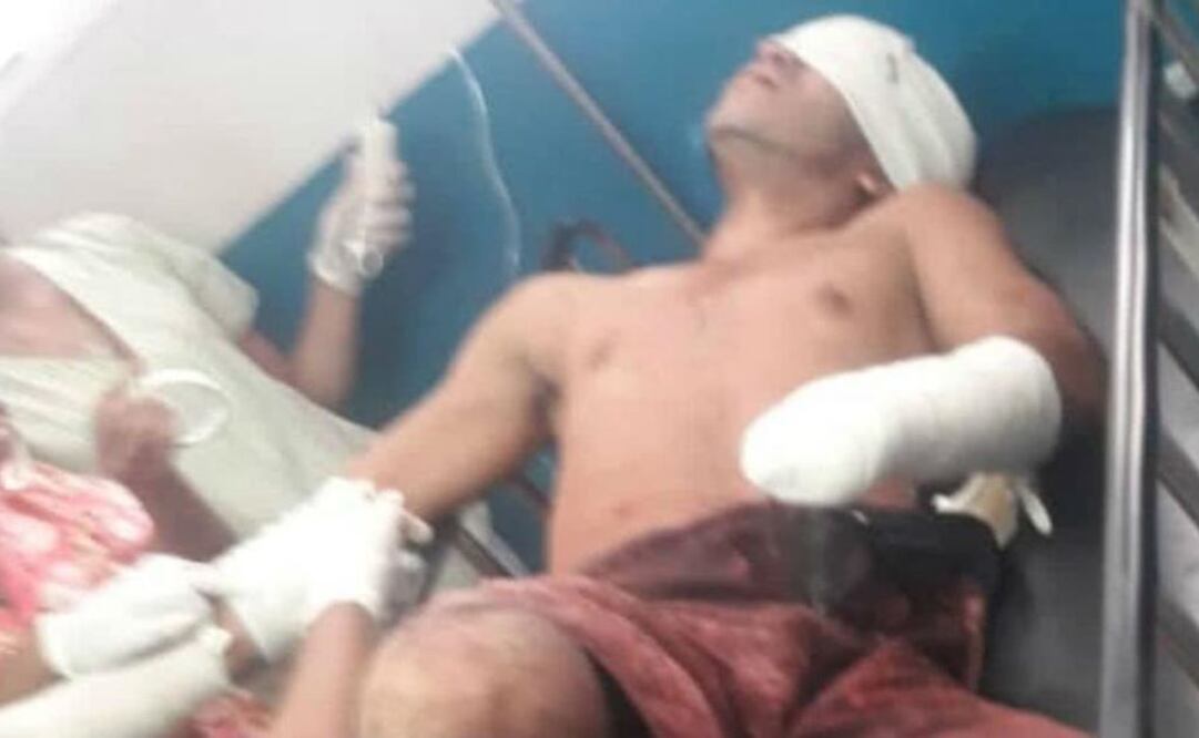 Mutilaron las manos, sacaron los ojos y cortaron la lengua a soldado en mina de Venezuela. (Foto: El Comercio / Perú / GDA)
