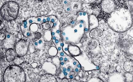 Tratamientos contra el Covid-19 dan esperanza bloqueando el coronavirus