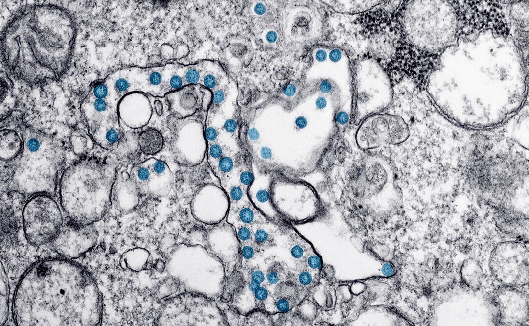 Foto: Hannah A. Bullock, Azaibi Tamin/CDC via AP, archivo