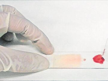 El virus de la malaria, un reto para la ciencia