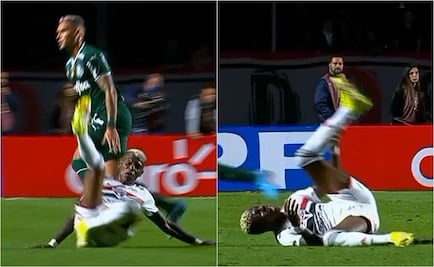 VIDEO: La horrible lesión de Robert Arboledas, jugador ecuatoriano que se perdería el Mundial de Qatar 2022