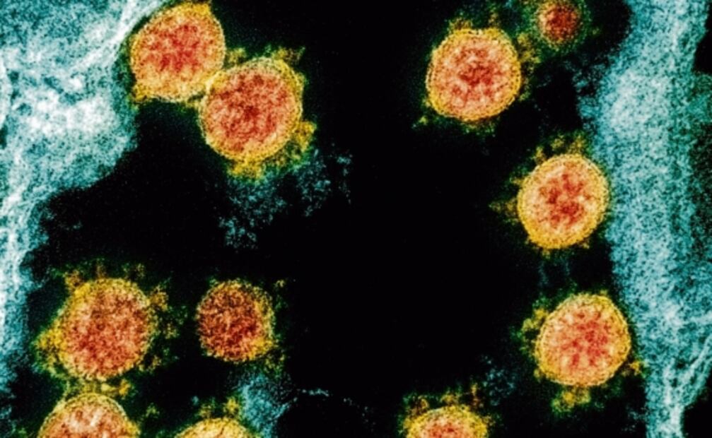 El cambio climático permitió la aparición del Covid-19: estudio