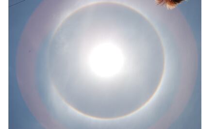 Protector solar reduce riesgo de cáncer: especialista