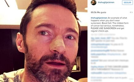 Hugh Jackman recibe otra vez tratamiento contra cáncer