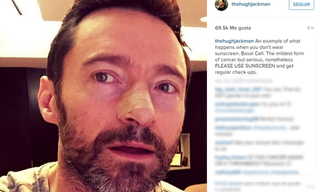 Hugh Jackman recibe otra vez tratamiento contra cáncer