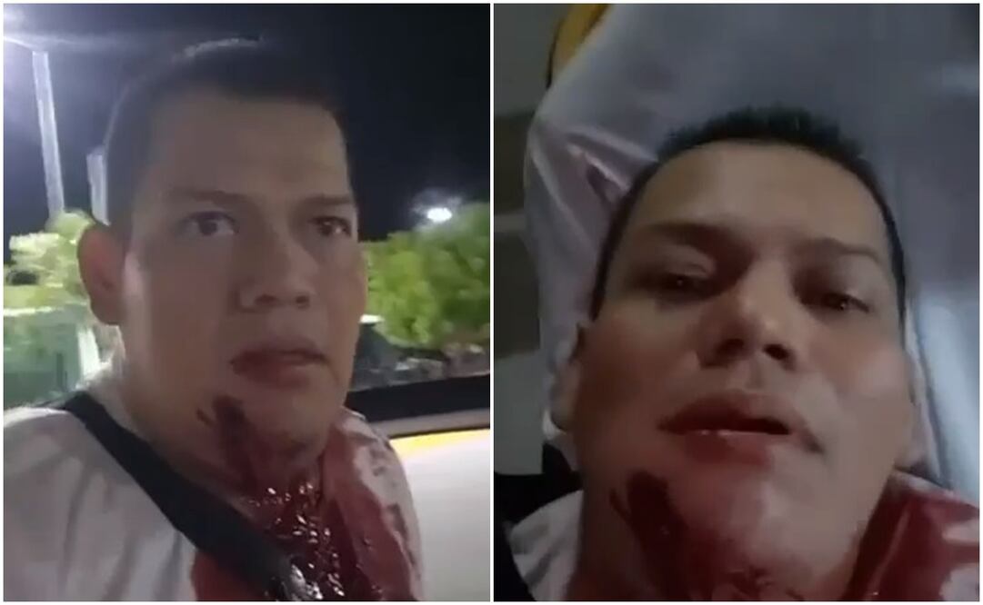 "Me pegaron. ¡Ayúdenme; ayúdenme!", decía el activista en plena transmisión en vivo en Apatzingán. Foto: Captura de video