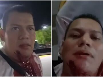 "Me pegaron, ¡ayúdenme!": balean a activista que criticaba inseguridad en Apatzingán; transmite en vivo aún herido
