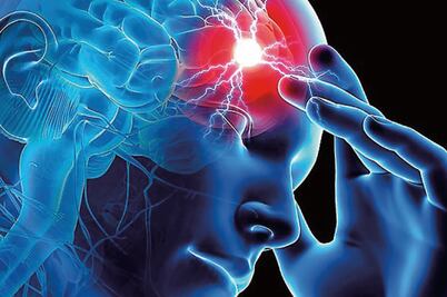 Isquemia cerebral aguda: una amenaza creciente