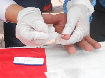 A propósito de variantes. Detectan a VB, un tipo de VIH más contagioso 