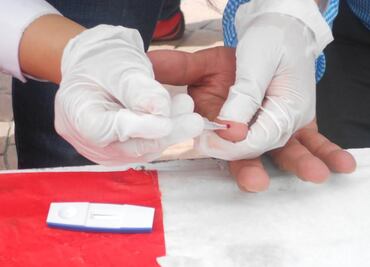 A propósito de variantes. Detectan a VB, un tipo de VIH más contagioso