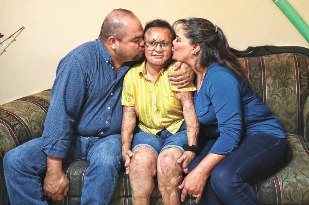 Alejandra fue la bebé más afectada por el incendio de la estancia infantil; su madre también estaba ahí y resultó con quemaduras.