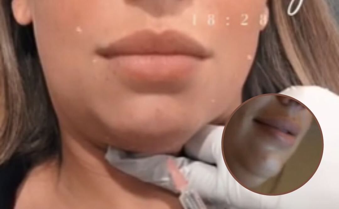 Terminó con el rostro desfigurado. Foto: TikTok @missdvaliantis