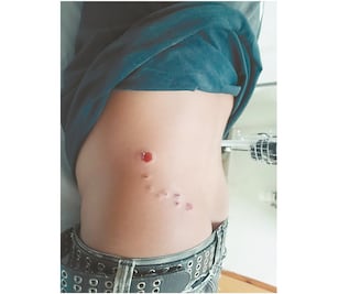 Ataque armado deja dos lesionados