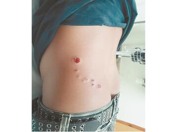 Ataque armado deja dos lesionados