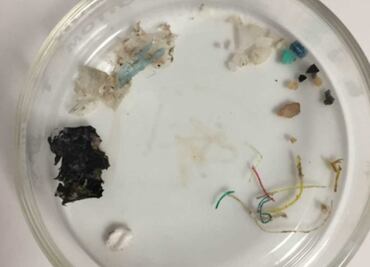 Detectan microplásticos en la sangre humana por primera vez; científicos aún desconocen cómo afectaría a la salud