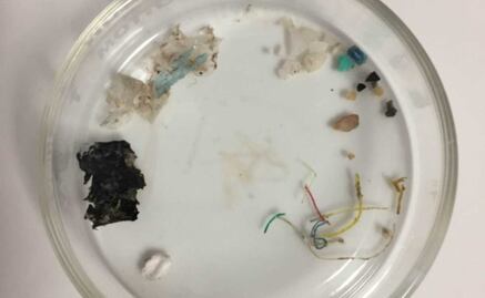 Detectan microplásticos en la sangre humana por primera vez; científicos aún desconocen cómo afectaría a la salud