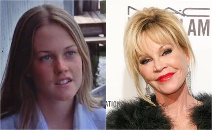 Así se ha transformado el rostro de Melanie Griffith