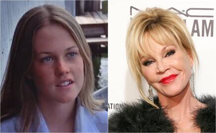 Así se ha transformado el rostro de Melanie Griffith
