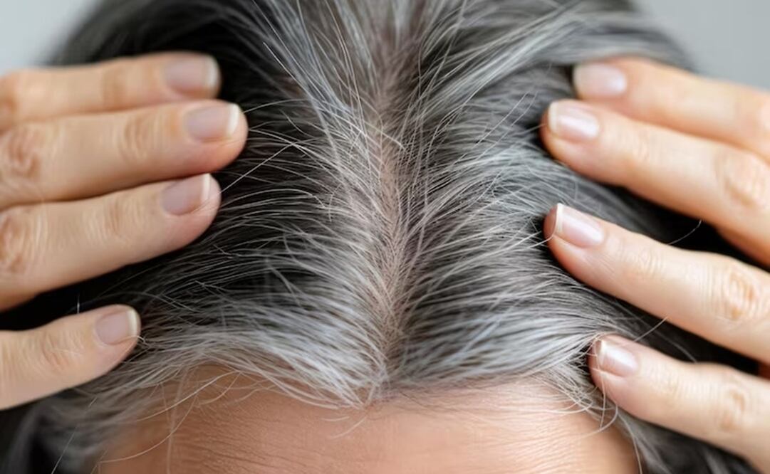 Restaura el color de tus canas con este remedio casero. Foto: Freepik
