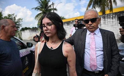 Alana Anisio Rosa sobrevive a intento de feminicidio en Brasil; rechazó a su acosador y fue apuñalada 50 veces