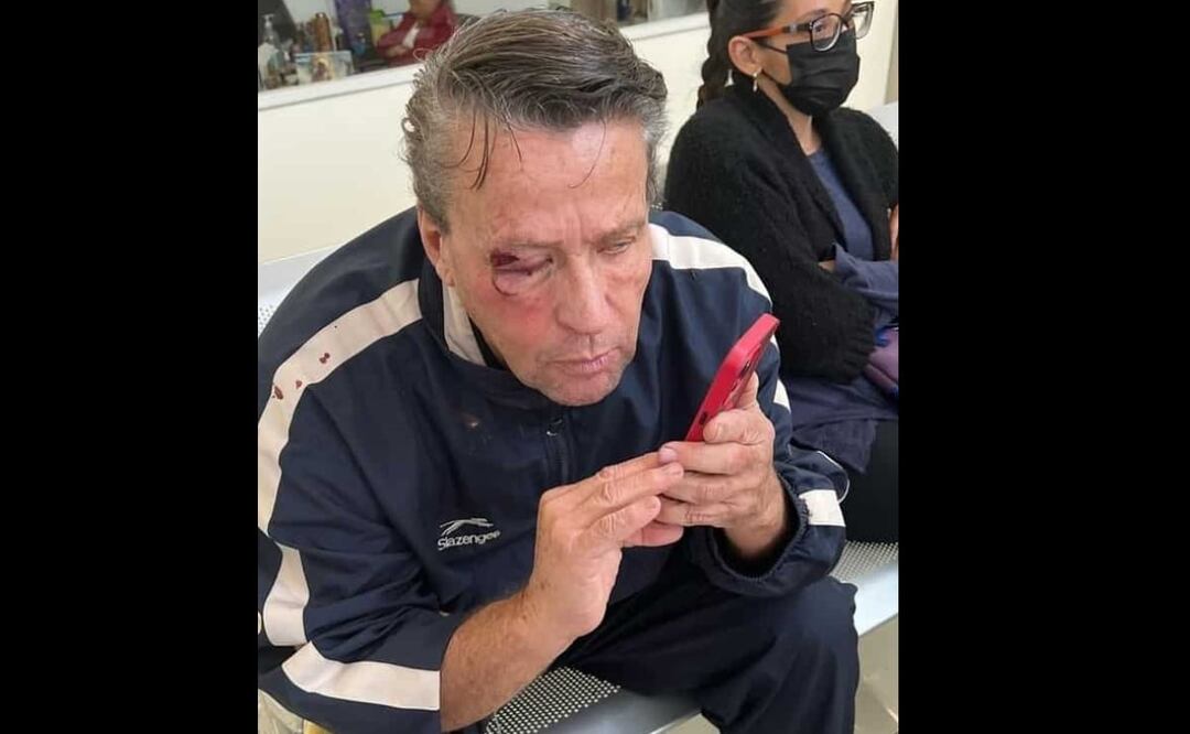 Golpean a Alfredo Adame por intentar grabar a dos personas baleadas en Tlalpan
