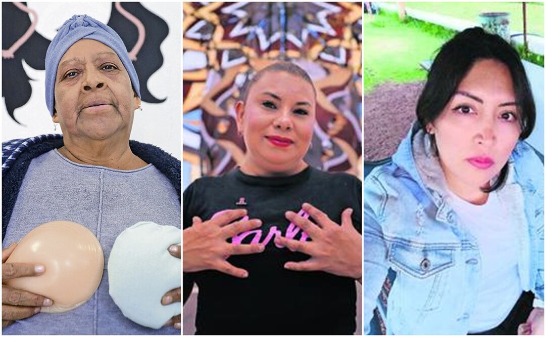 Cáncer de mama. Foto: Fernanda Rojas y Especial