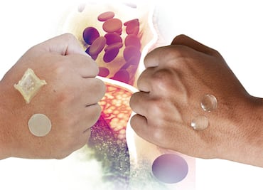 UNAM crea parche transdérmico para combatir colesterol