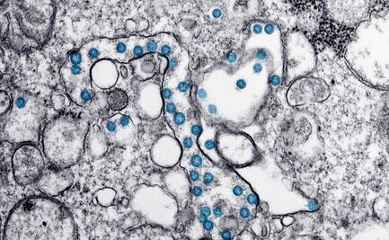 Covid-19. Crean potente antiviral procedente de las llamas contra el coronavirus
