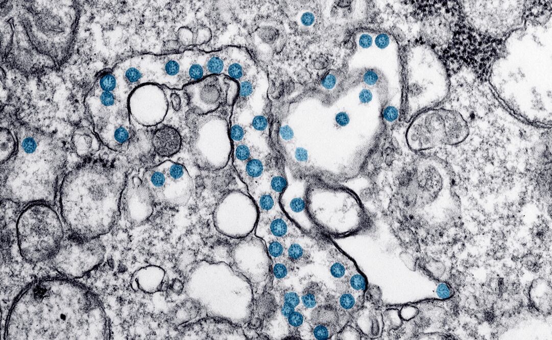 Foto: Hannah A. Bullock, Azaibi Tamin/CDC via AP, archivo