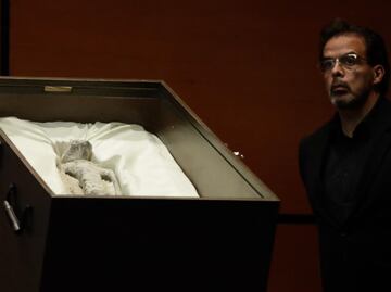 UNAM se deslinda de dichos de Maussan sobre cuerpos "no humanos" presentados en San Lázaro