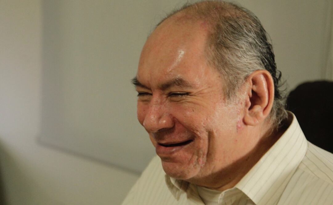 Imagen de archivo de un hombre con esquizofrenia. Foto: Archivo El Universal