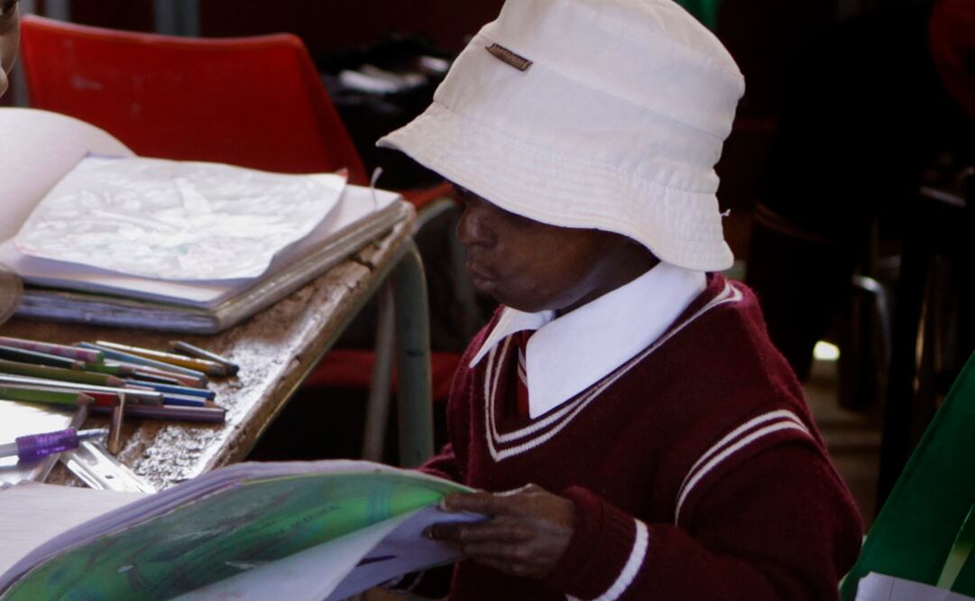 Imagen de archivo de un niño con progeria. Foto: AP, archivo