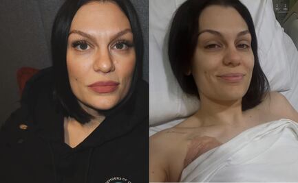 Jessie J, hospitalizada de urgencia por complicaciones luego de su cirugía de cáncer de mama