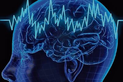 Crean sistema de cómputo para hacer mapeos cerebrales