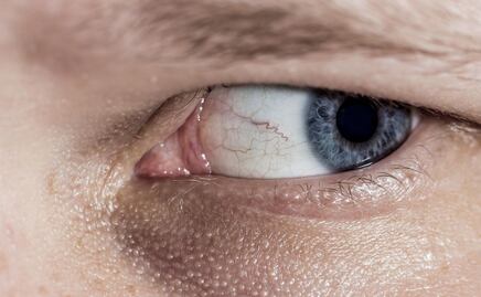 3 tipos de alimentos que previenen el glaucoma