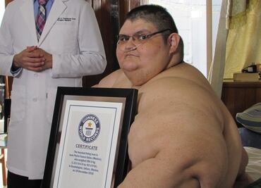 Hombre más obeso del mundo se levanta de la cama por primera vez en 7 años