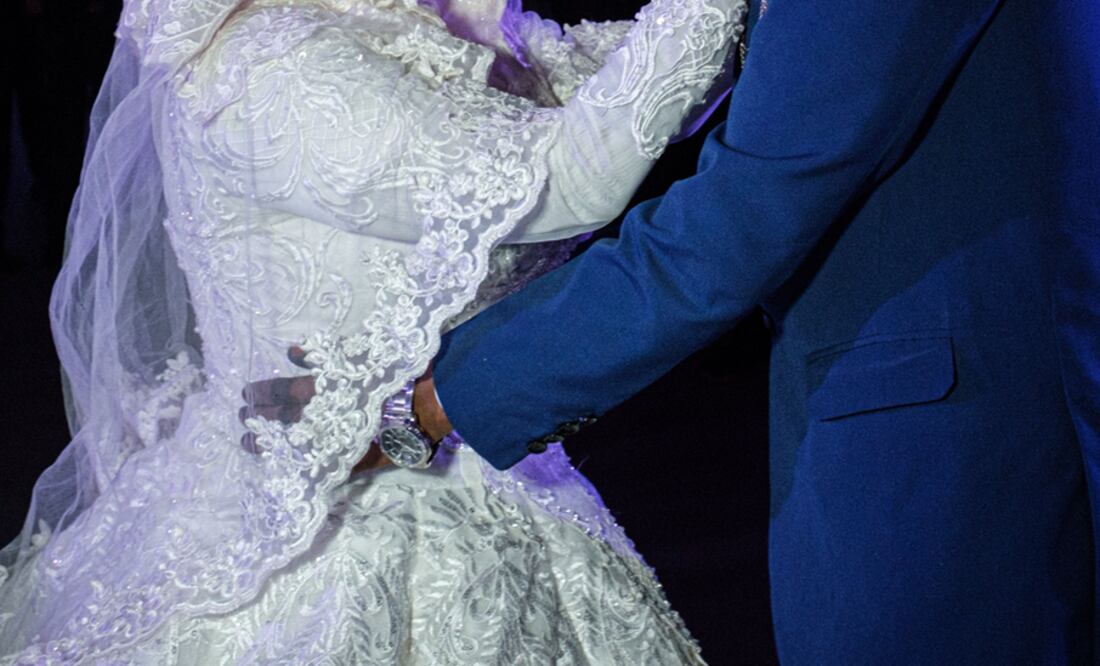 Si una novia opta por volver a someterse a una MGF, la operación puede involucrar cortar más labios genitales y volver a suturar la vagina. Foto: AFP