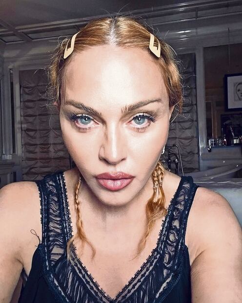 Madonna pausa  su gira mundial por grave infección bacteriana