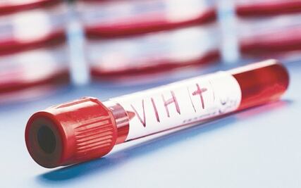 ¿Cuál es la diferencia entre el VIH y el SIDA?