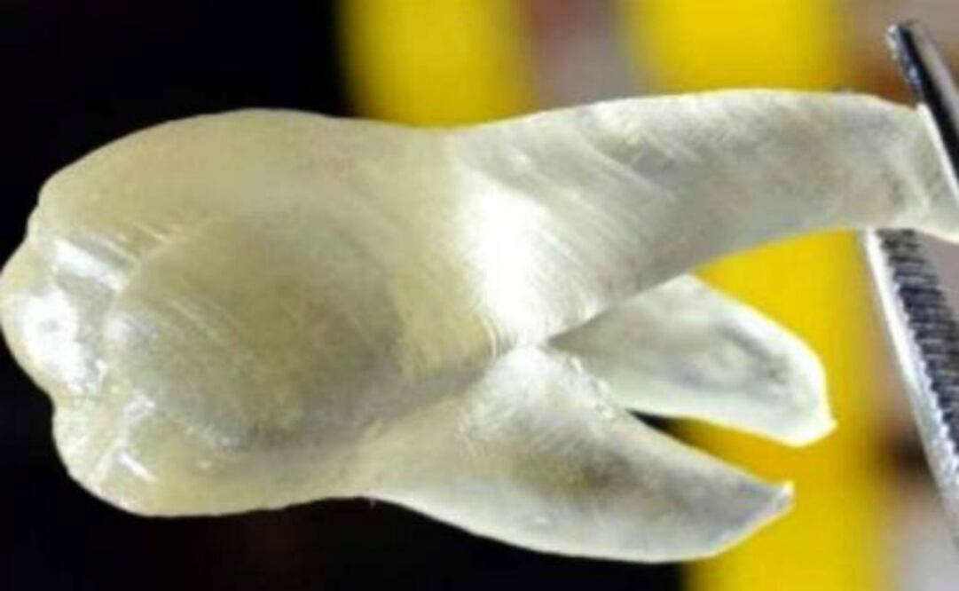 Las características de estos dientes disminuye la formación de una película biológica en el elemento impreso que reduce el riesgo de caries 