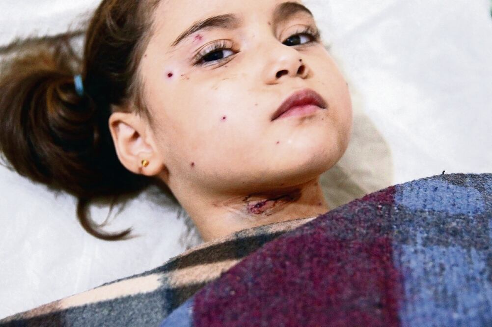 Al menos seis niños murieron ayer en bombardeos del Ejército sirio en Harasta. En la imagen, una de las menores heridas (BASSAM KHABIEH. REUTERS)