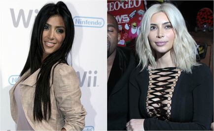 ¿Qué se ha hecho Kim Kardashian en el rostro?