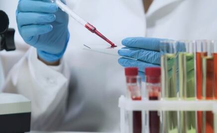 Eliminan el VIH en un paciente de Londres, el segundo caso del mundo