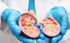 Urgen especialistas de la UNAM a contar con Registro Nacional de Enfermedad Renal Crónica; trasplante de riñón, el más solicitado