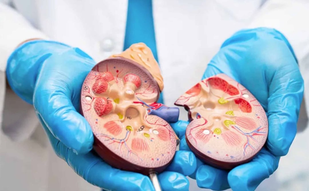 Urgen especialistas de la UNAM a contar con Registro Nacional de Enfermedad Renal Crónica. Marzo 2026. Foto: Especial