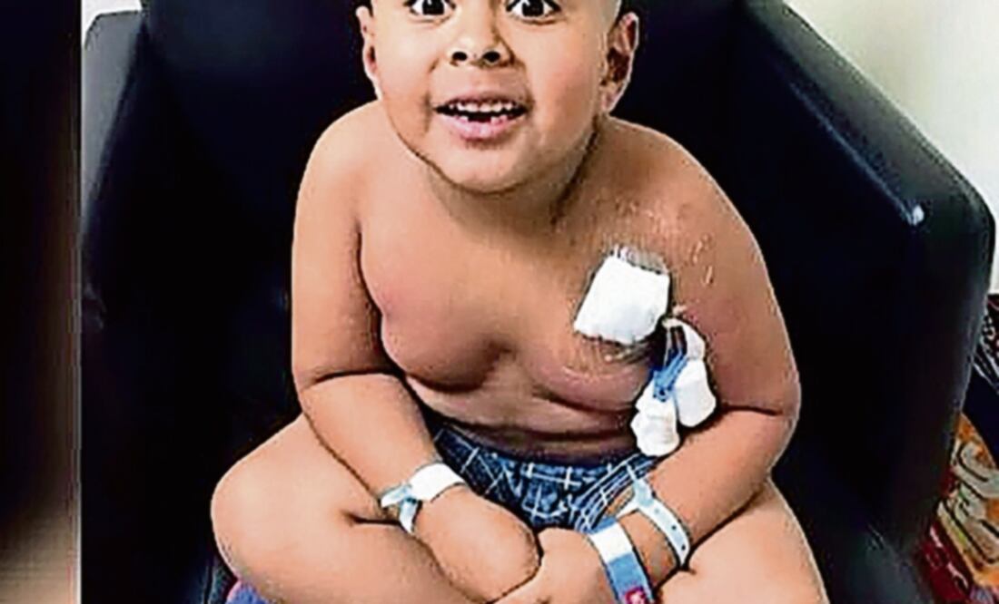 Diego tuvo complicaciones tras ser sometido a un trasplante de médula ósea