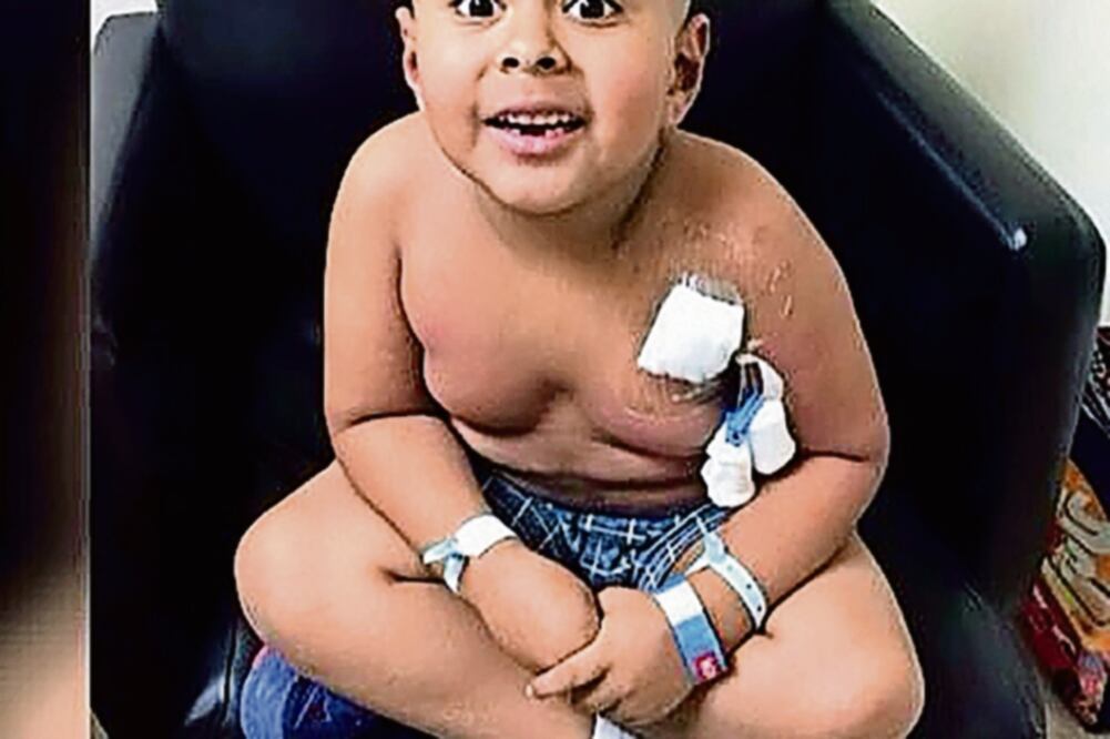 Diego tuvo complicaciones tras ser sometido a un trasplante de médula ósea