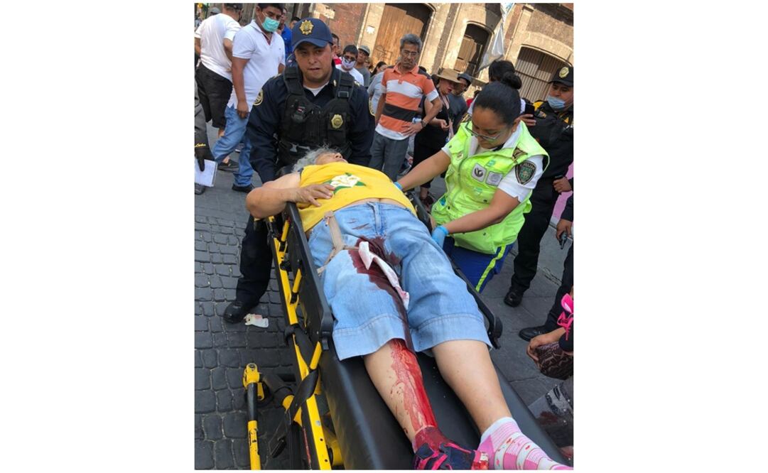 Dos mujeres resultaron heridas. Foto: Especial