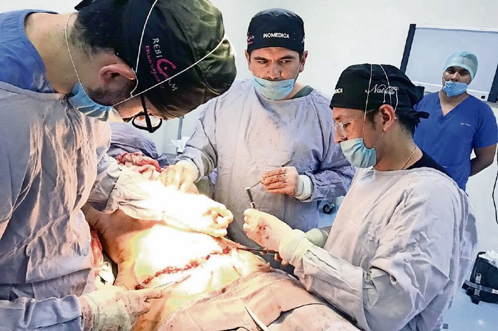 Autoridades de Salud informaron que en cinco años, más de 100 guanajuatenses que han superado el cáncer de mama han sido favorecidas con este tipo de intervenciones y sin costo alguno. Foto: CORTESÍA