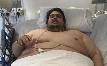 Muere el hombre más obeso de Gran Bretaña por insuficiencia cardiaca
